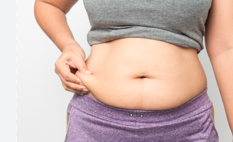 belly fat women